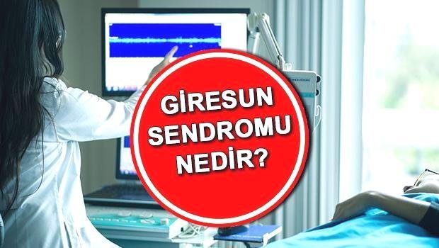 dunyada-ilk-kez-gorulen-giresun-sendromu-Hl24Pdgz.jpg